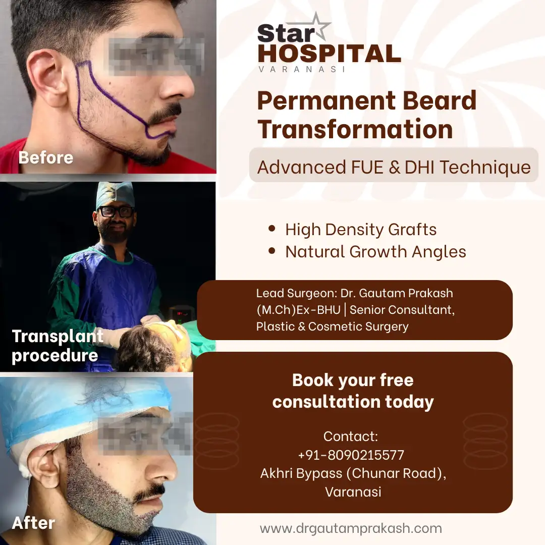 Permanent beard transplant transformation results at Star Hospital Varanasi, featuring advanced beard transplant with plastic surgery performed by the top plastic surgeon in Varanasi, Dr. Gautam Prakash.