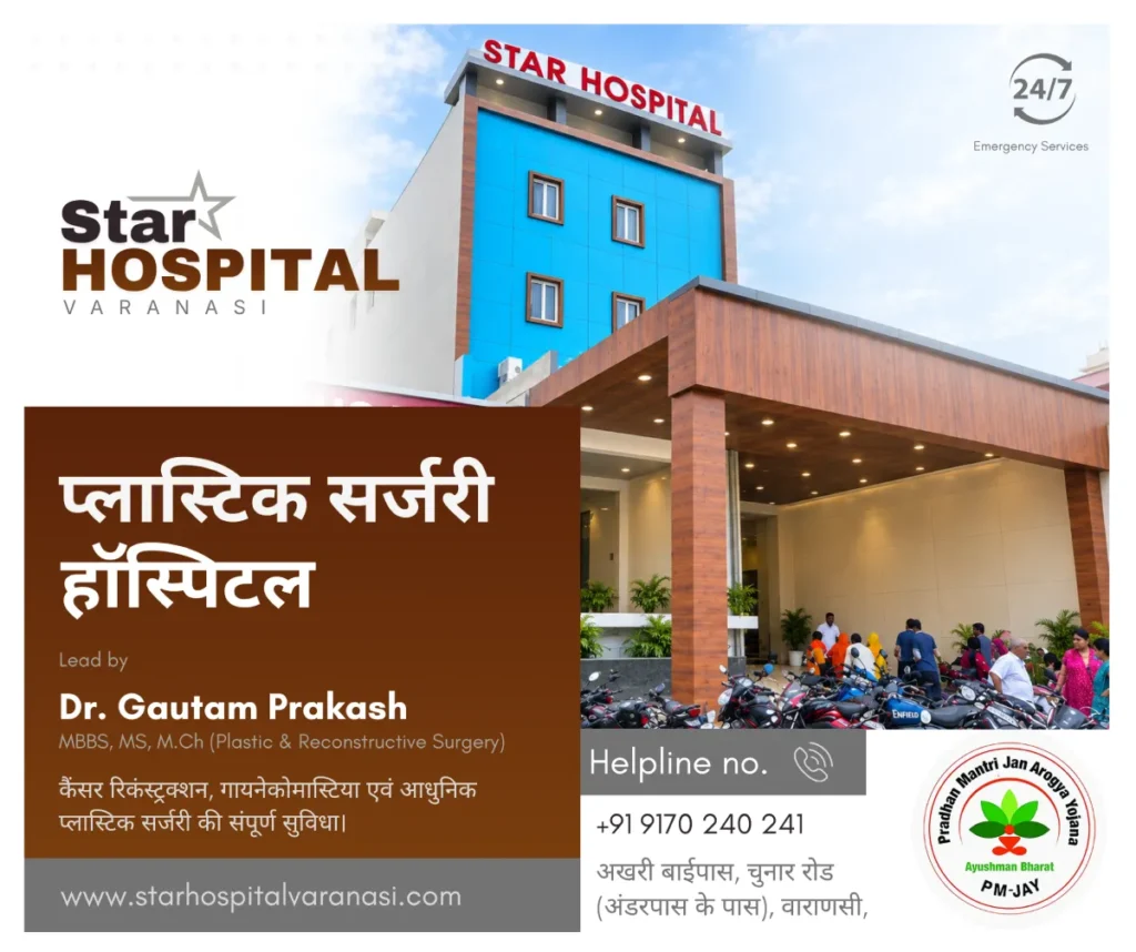 Best plastic surgery hospital in Varanasi Dr Gautam Prakash Star Hospital Akhari Bypass